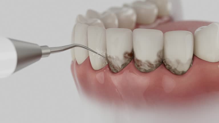 Trusted Invisalign Clear Aligners service in Golden Triangle, NJ - Dentist Open Now